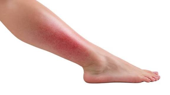 How Cellulogia Works — Techniques Behind This Wellness Trend